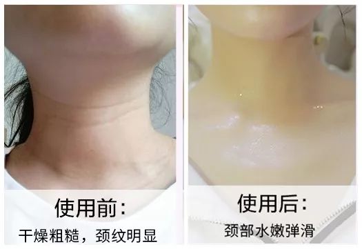 这款急救弹性蛋白贴,每天一片赶走干纹,还你天鹅美颈