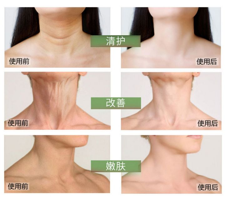 这款急救弹性蛋白贴,每天一片赶走干纹,还你天鹅美颈