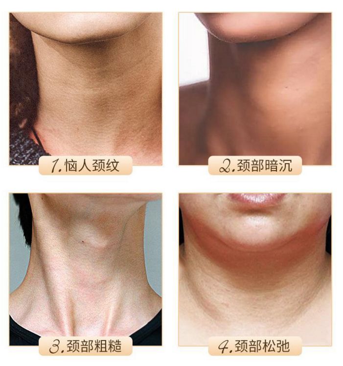 这款急救弹性蛋白贴,每天一片赶走干纹,还你天鹅美颈