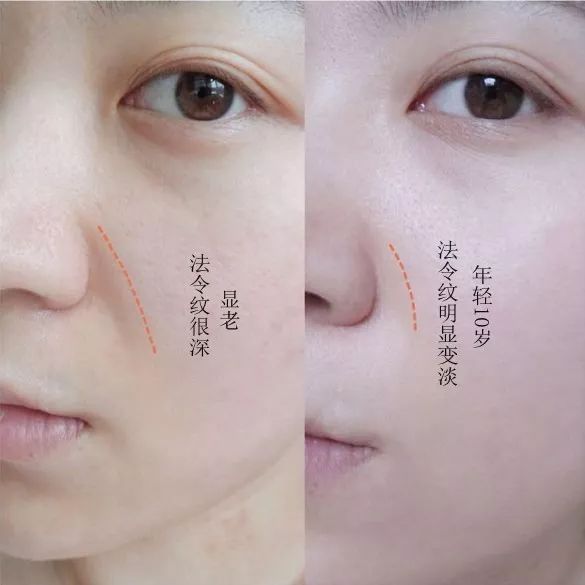 这款急救弹性蛋白贴,每天一片赶走干纹,还你天鹅美颈