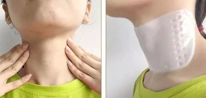 这款急救弹性蛋白贴,每天一片赶走干纹,还你天鹅美颈