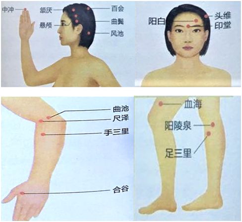 头痛20年医生精准施治,顽固性头痛看哪位中医专家