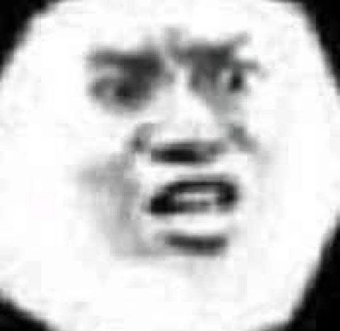 19岁女孩天天吃鱼，竟导致手脚“满目疮痍”！医生一句话道出真相