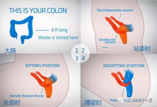 医学知识科普排便,排便困难病人的健康宣教