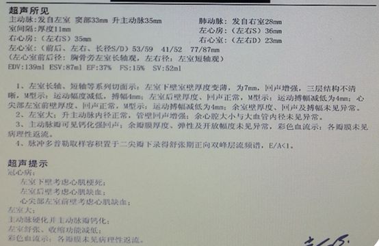 缺血性心肌病心衰恢复,缺血性心衰能逆转吗