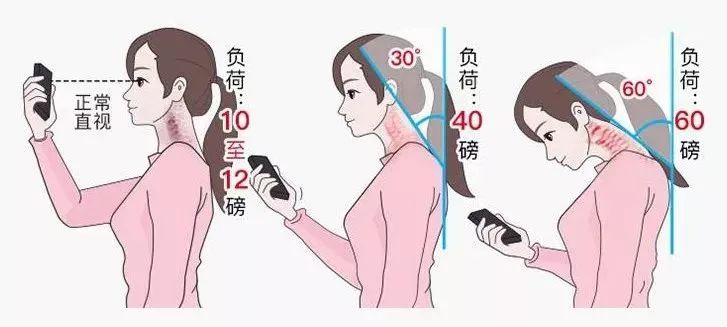 无痛拯救12亿低头族！5分钟搞好酸、痛、僵、麻，解颈椎“夺命包”