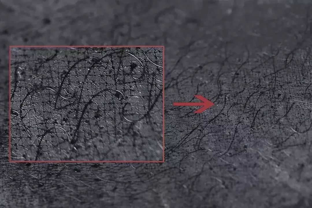 无痛拯救12亿低头族！5分钟搞好酸、痛、僵、麻，解颈椎“夺命包”