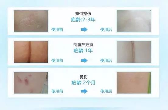 冲刺双11价格直降,比双11更大的优惠