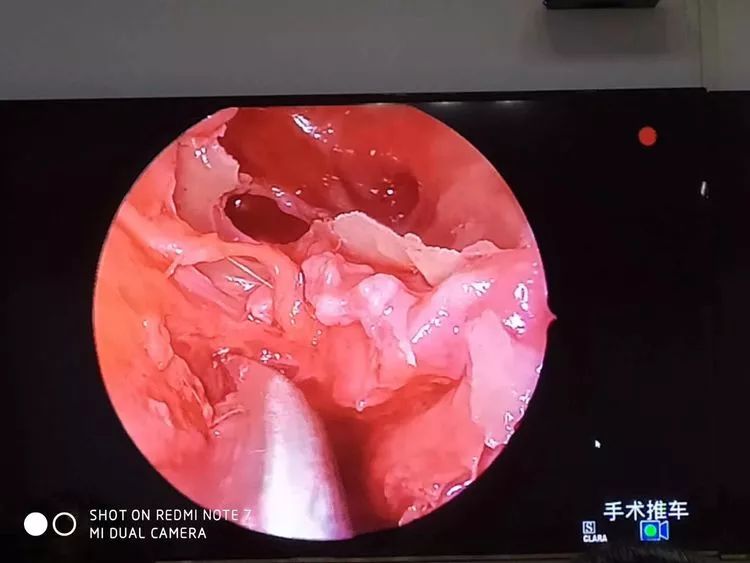 鼻整形实战技术高峰论坛,鼻科学