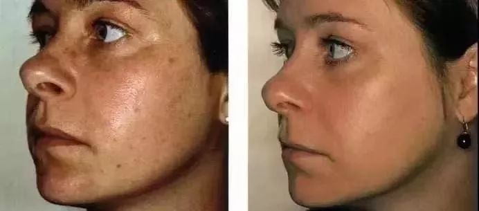 日本去角质磨砂膏,日本去角质脸部清洁第一名