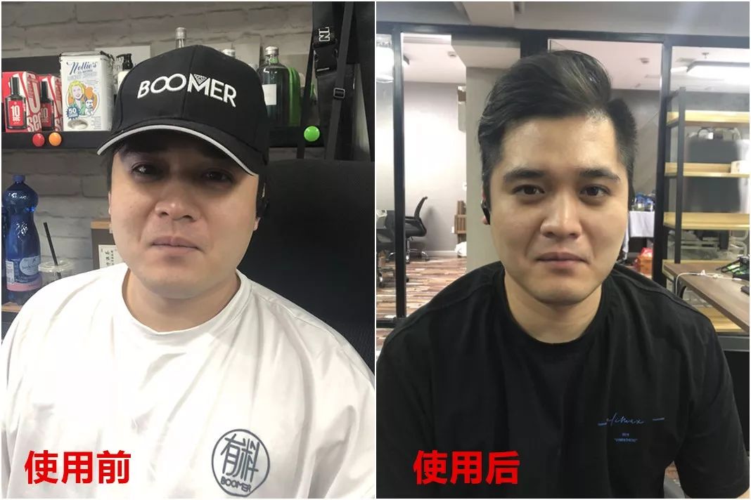 日本黑科技磁石瘦脸耳环,日本磁吸瘦脸耳环