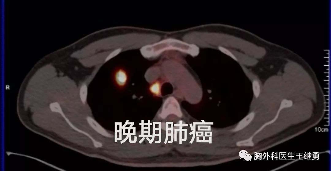 香港人卖房什么心态,香港人买房治病