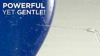 洗牙神器是真的管用,洗牙神器去牙结石永久有效果