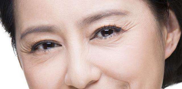 眼角纹很严重怎么才能消除,如何消除眼角纹眼袋小妙招
