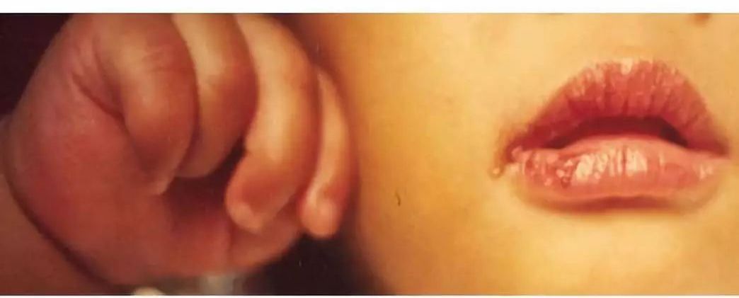 血压升高低烧拉肚子,发热头晕腹泻是什么病