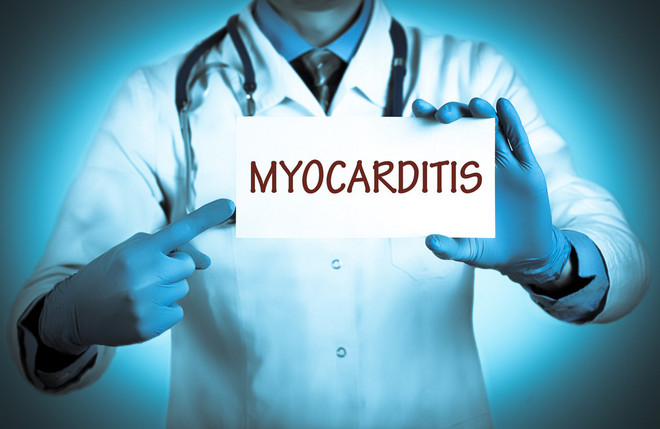 感冒跑步有助于恢复吗,感冒能跑步吗科学讲解