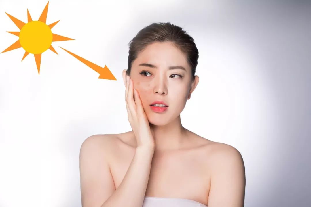 褐斑怎么处理,褐斑怎么消除最快方法