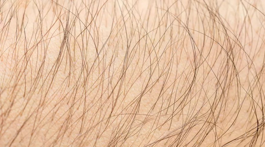 脱毛秋冬季是不是比较好,秋冬才是脱毛的最佳时间