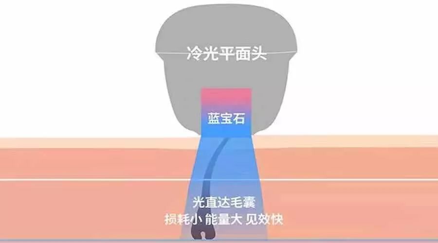 脱毛秋冬季是不是比较好,秋冬才是脱毛的最佳时间