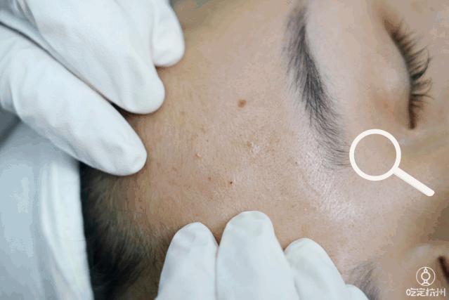 疯了!比1折还低!9店通用!火爆杭城的资深皮肤管理中心,唤醒秋日少女肌