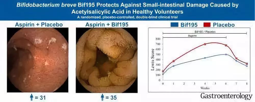 Gastroenterology封面：双歧杆菌可防治阿司匹林引起的溃疡；胶带测儿童湿疹|知几研究速递Vol.33