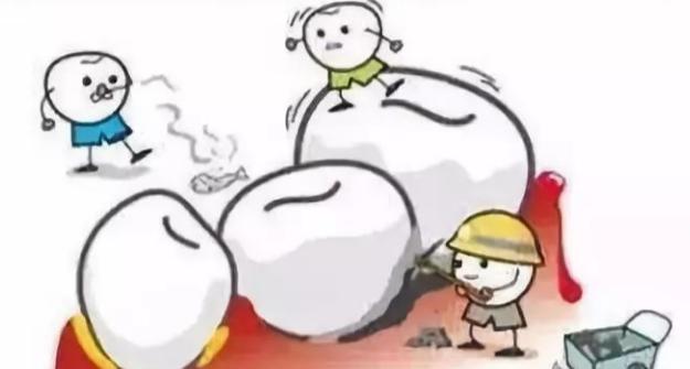 牙缝牙石怎么去除,牙缝里面有牙垢洗牙可以洗掉吗