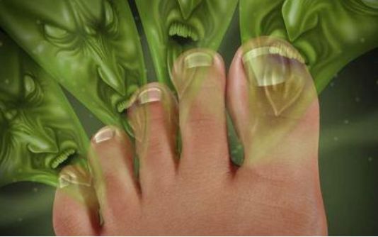 什么袜子踢球不起泡,汗脚穿什么样材质袜子不臭