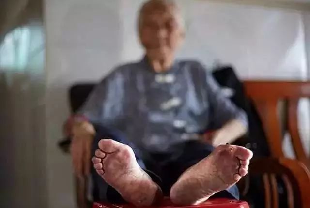 什么袜子踢球不起泡,汗脚穿什么样材质袜子不臭