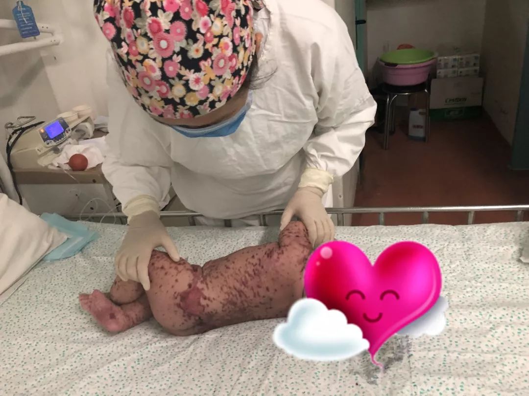 变形记结构,变形计黎平