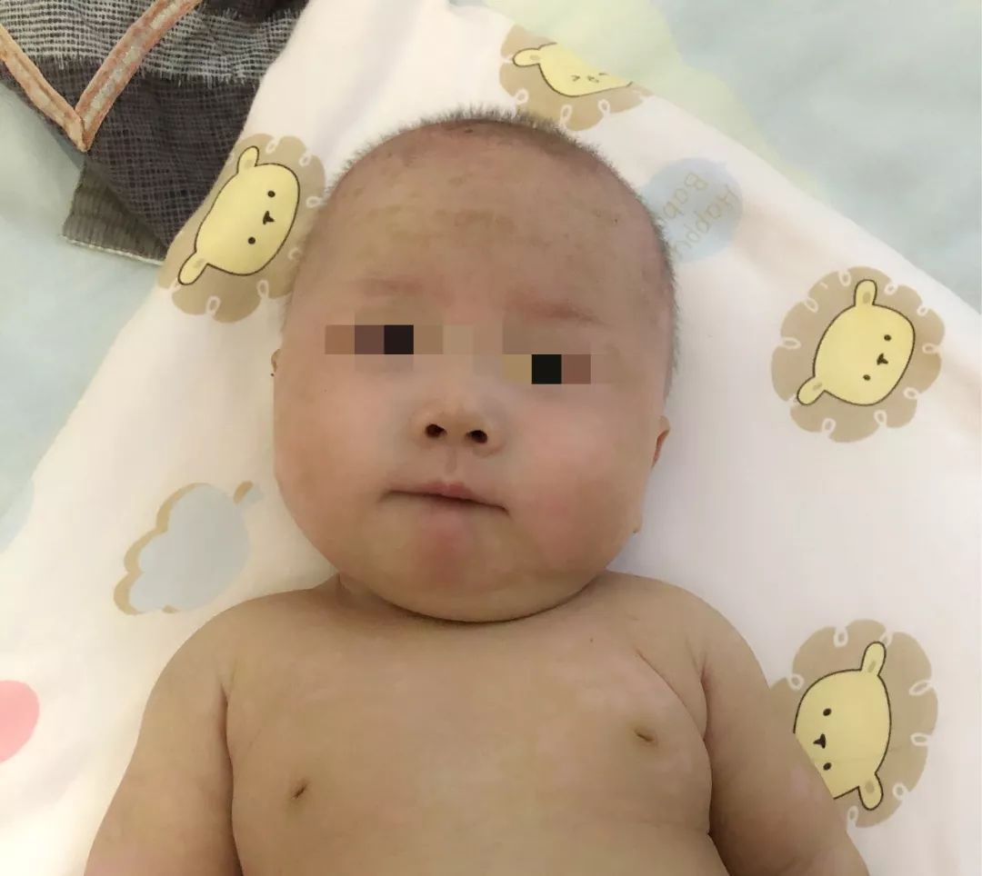 变形记结构,变形计黎平