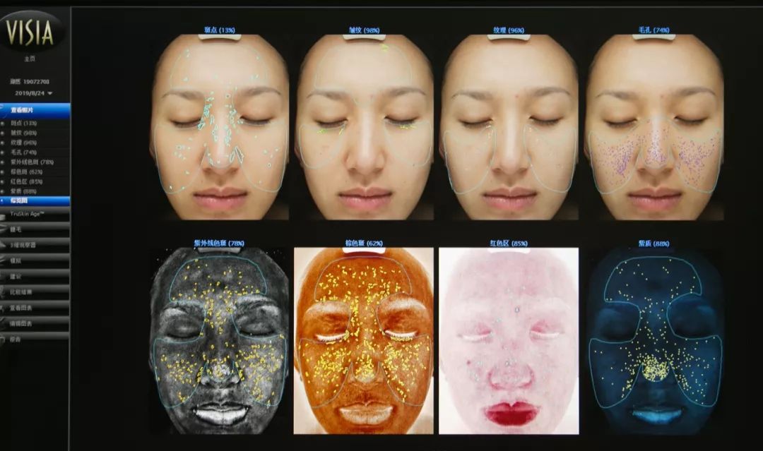 肌诊室水光肌挑战,肌诊室修复