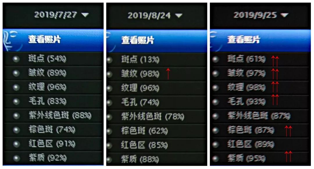 肌诊室水光肌挑战,肌诊室修复
