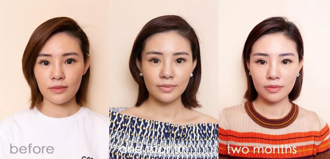 肌诊室水光肌挑战,肌诊室修复