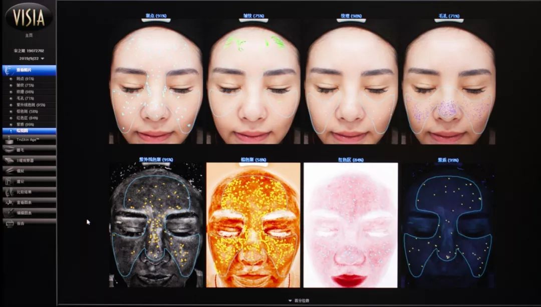 肌诊室水光肌挑战,肌诊室修复