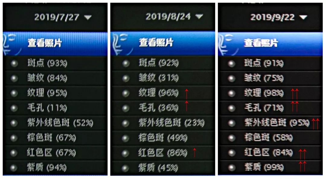 肌诊室水光肌挑战,肌诊室修复