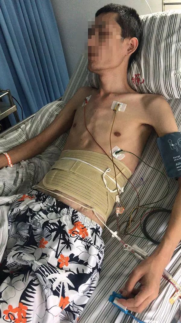 肺结核感染新闻,医疗过错导致患者感染肺结核