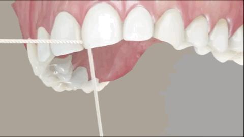 刷牙和使用牙线的科普文章,用牙线清洁牙齿的手法教学