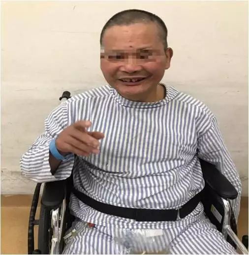 中暑会对大脑造成不可逆的损伤,中暑会导致大脑缺氧吗