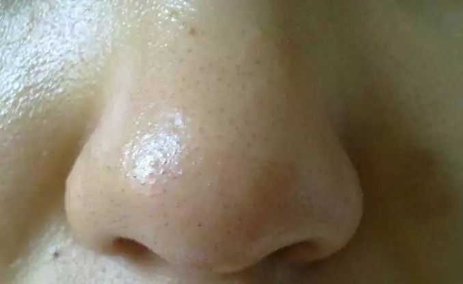 日本草莓鼻去黑头最有效的产品,byebye草莓鼻去黑头神器大揭秘