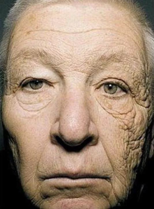 皮肤衰老的10个信号，皱纹只能靠后站|好课推荐