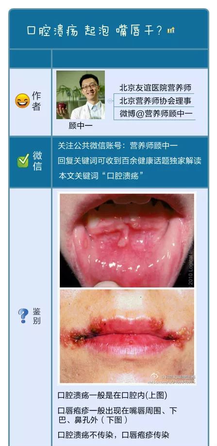唇舌溃疡长不停怎么办,上唇干起泡