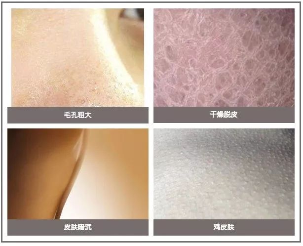 北欧女生冬季穿搭,北欧妹子