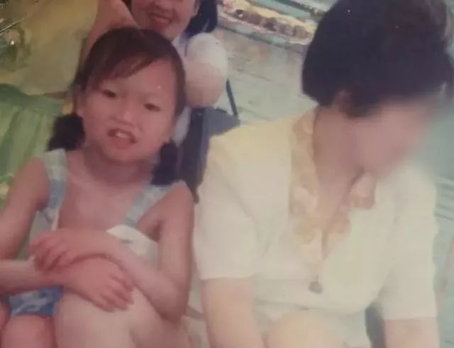 20岁女子罕见怪病一夜变老,22岁女子患罕见怪病