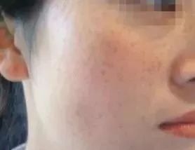 你皂吗？ta凭借淡斑美白效果，被外国姑娘囤疯了