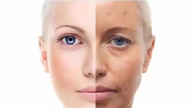 你皂吗？ta凭借淡斑美白效果，被外国姑娘囤疯了