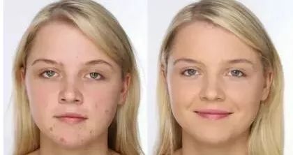 你皂吗？ta凭借淡斑美白效果，被外国姑娘囤疯了