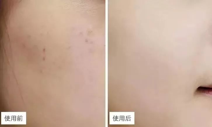 你皂吗？ta凭借淡斑美白效果，被外国姑娘囤疯了
