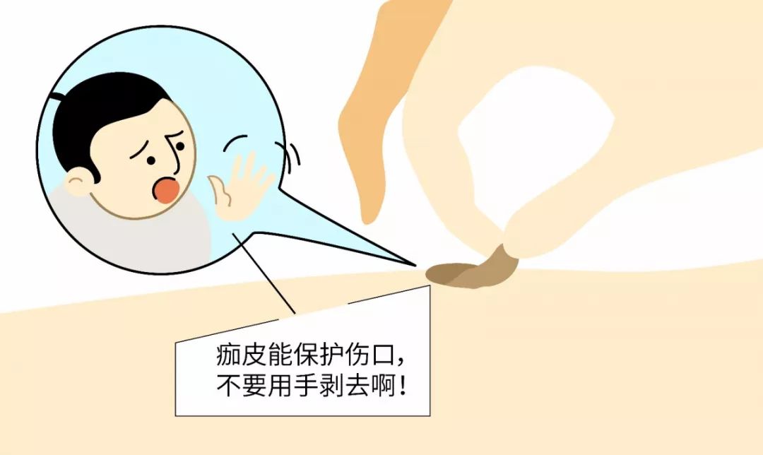 【名医】“我”是万人厌的伤疤,这篇微信教你怎样处理“我”