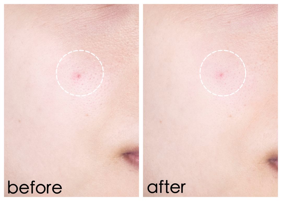 推广双十一优惠券,晒晒你的双十一购物单