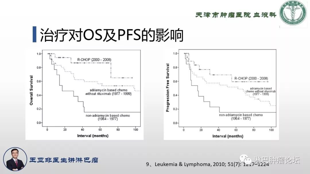 原发性脾淋巴瘤,原发淋巴瘤诊断标准
